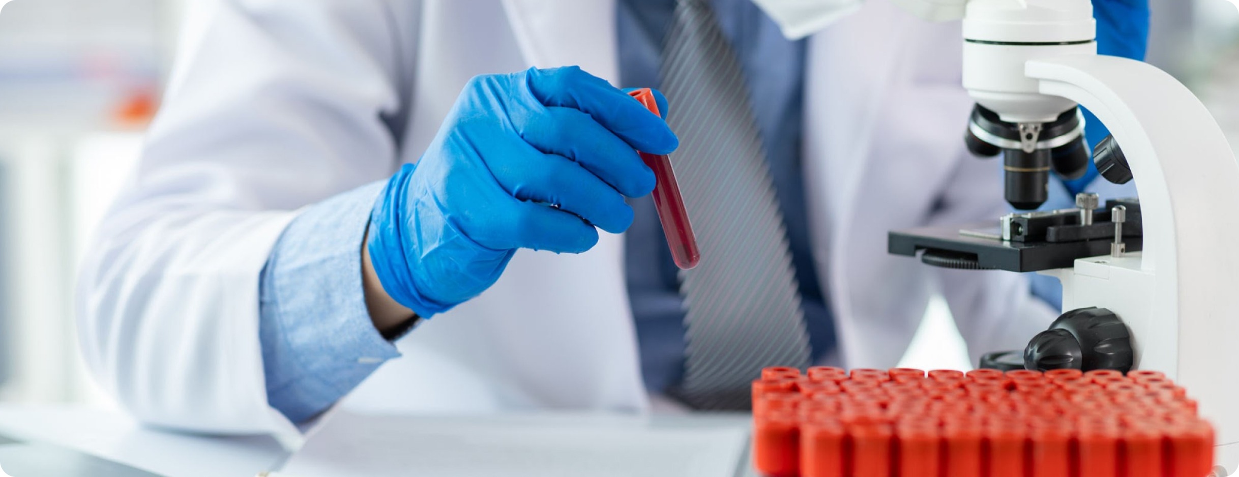 Why Typhoid Risk Rises During the Festival Season (3)